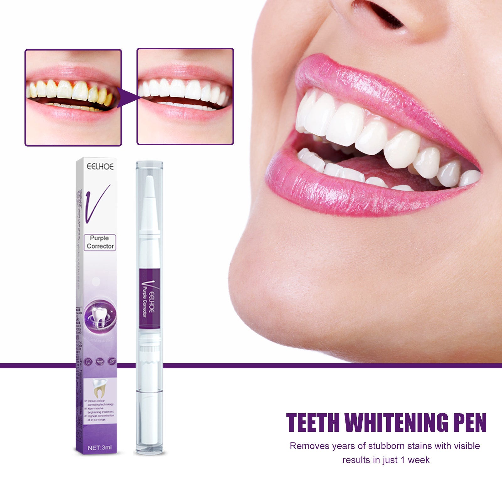 V34 Purple Dental Pen Oral Cleaning, Removing Stains And Brightening Teeth Oral Care Dental Pen